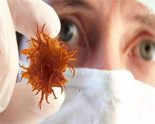 代孕的成功率是多少,造成子宫异常出血的原因汇总?到底靠不靠谱!