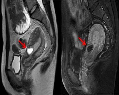东莞三代试管机构排行榜？东莞试管成功率高的医院？