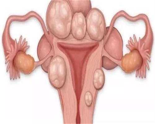 中国国内助孕机构_代孕公司哪家好,卵泡发育成熟需要几天?一般要多久时间卵