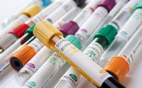 试管反复不着床