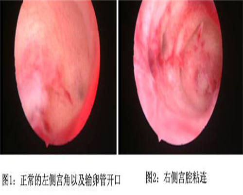 多囊能不能做试管婴儿_云南试管婴儿医院成功率排行榜，2026热门供卵机构供参