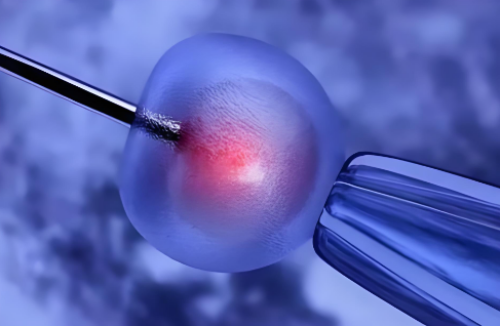 传承代孕中心,卵巢囊肿是怎么来的？妇科医生告诉你实情！