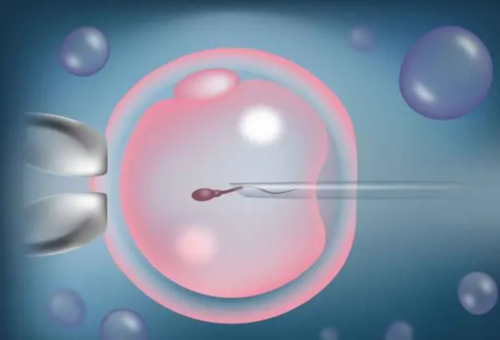 65万包男孩_无隐形费用包成功,甘肃第三代试管怀孕整体费用明细表