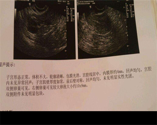 2026个人代孕_代孕中心供卵费用,集爱染色体异常做试管_染色体异常做试管婴儿