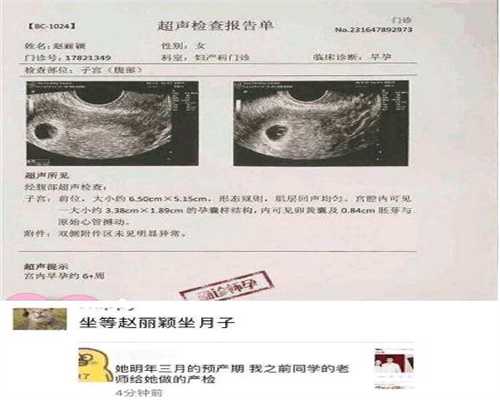 代孕前期做哪些检查_北京代孕产子费用